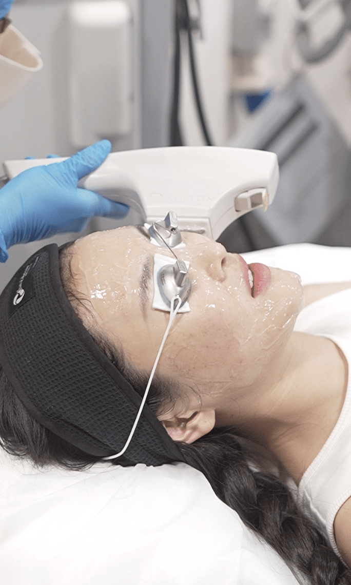 Forever Young BBL broadband light treatment for pigmentation and skin rejuvenation at Healthsprings Singapore
