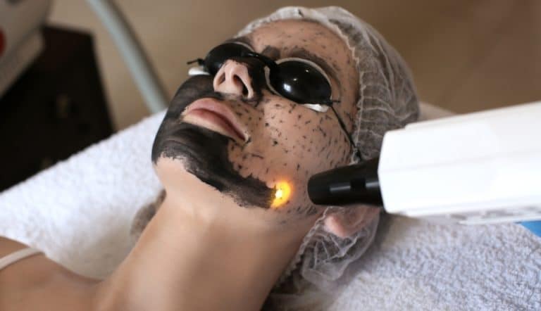 woman undergoing digital peel laser treatment