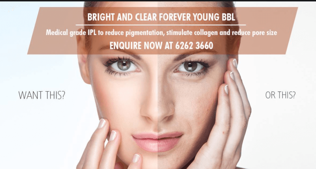 Bright and Clear Forever Young BBL