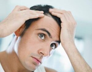 HAIR LOSS