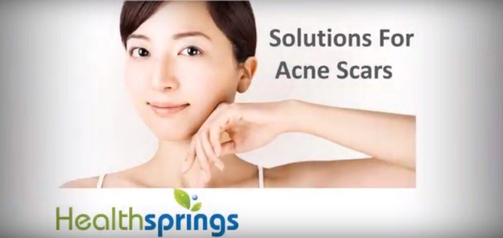 SOLUTIONS FOR ACNE SCARS