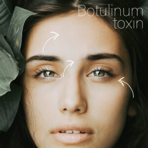 BeautyFix #3 Wrinkles Removal (Botulinum Injection)