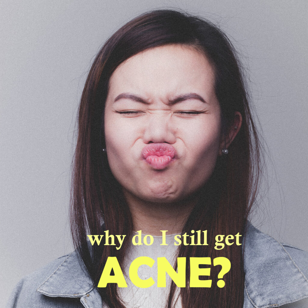 acne