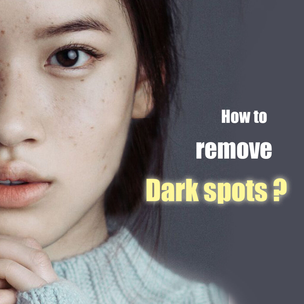 darkspots