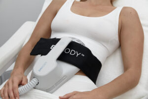 What is Diastasis Recti aka mummy tummy