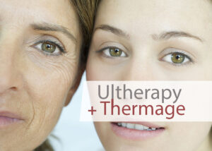 Thermage & Ultherapy to lift & tighten the face