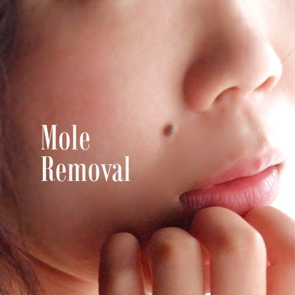 mole3