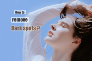 Anyone can get sun spots. 2
