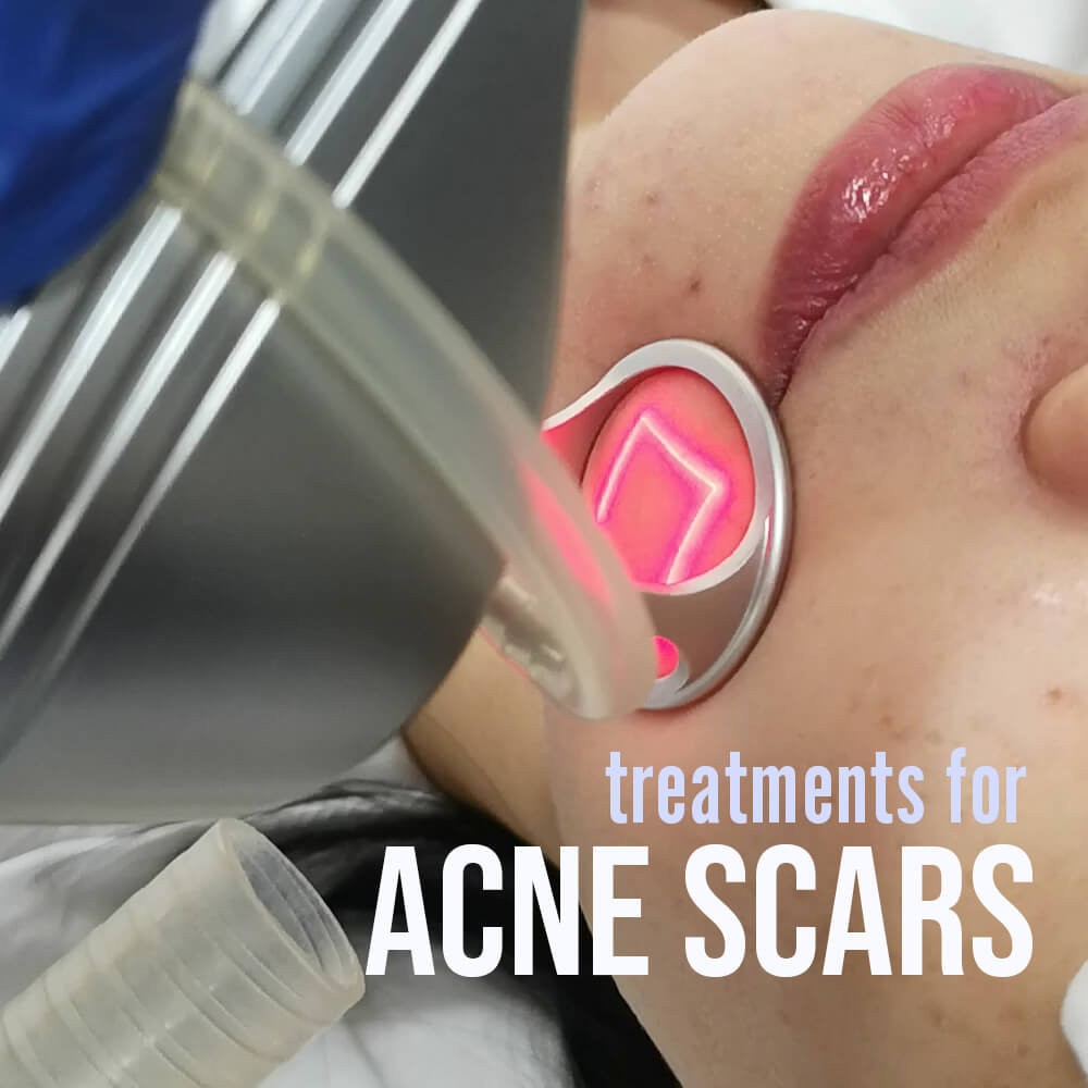 scnescars 1