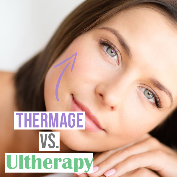 thermage