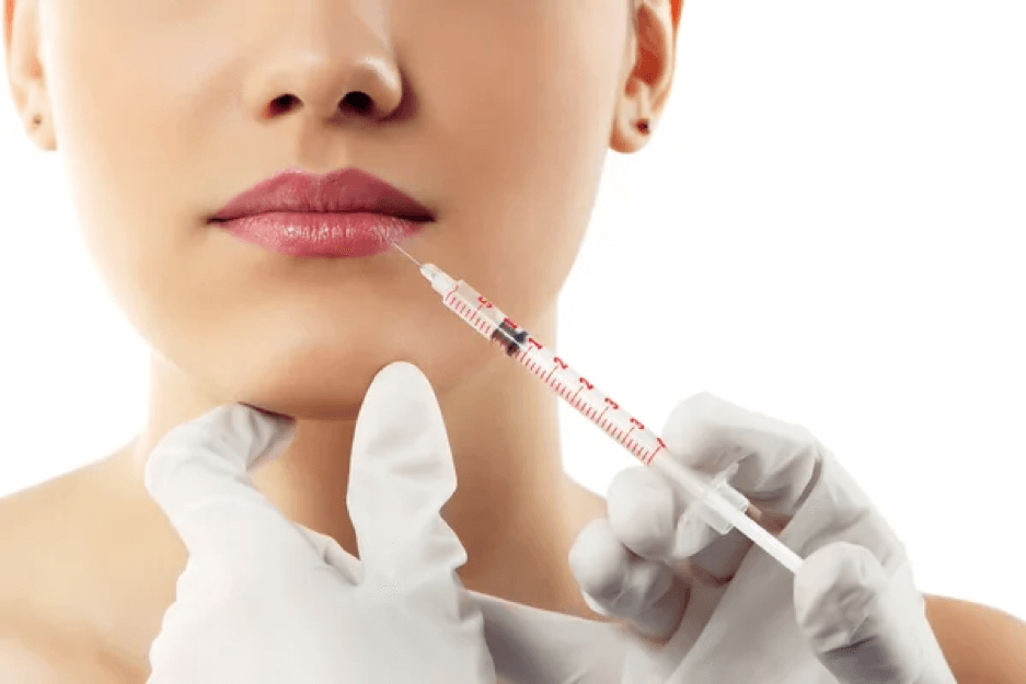 woman undergoingaesthetic treatment which is lip filler injection