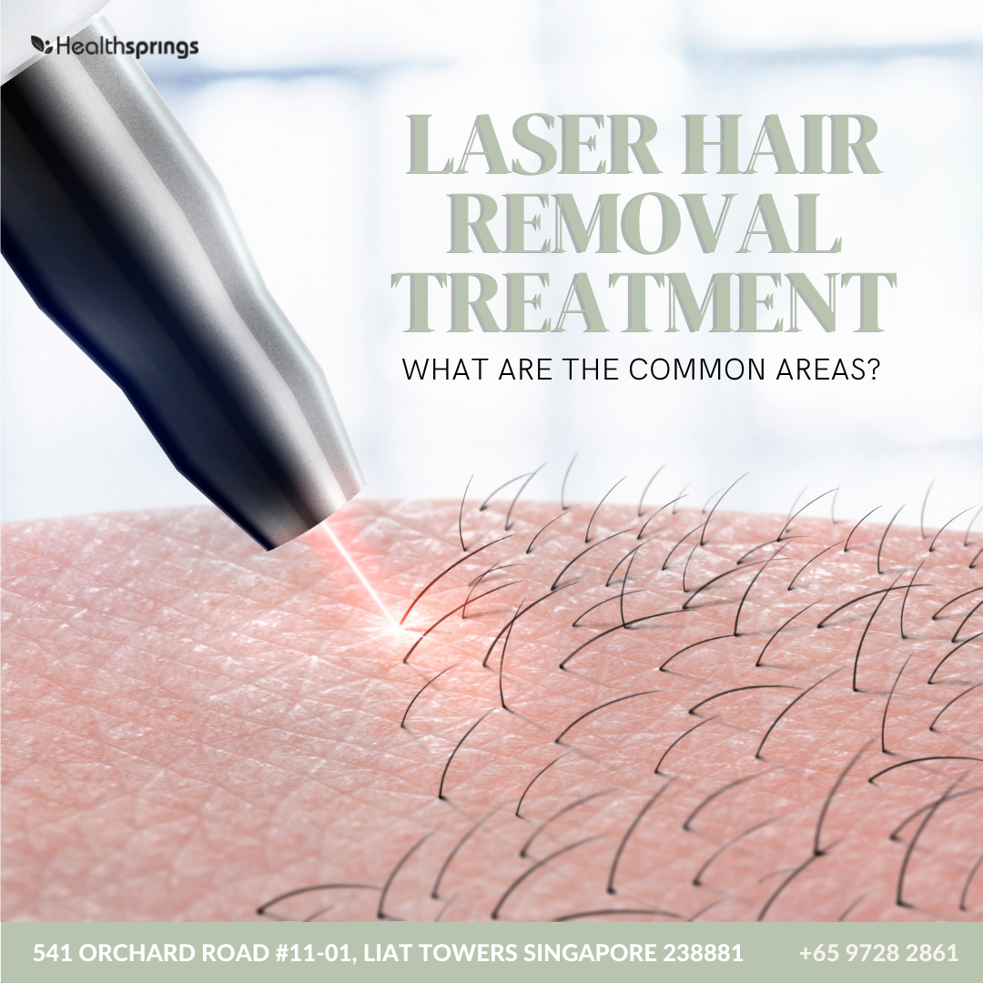 What are the common areas for Laser Hair Removal Treatment