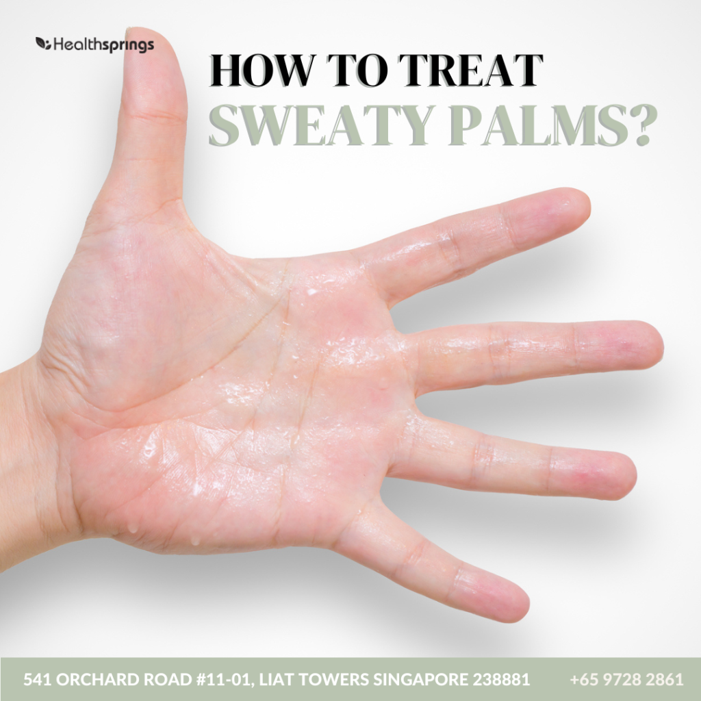 how to treat sweaty palms