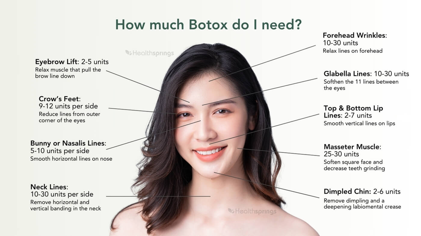 How much Botox do I need