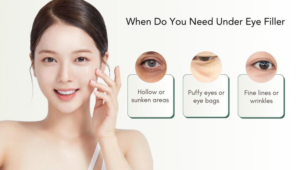 When Do You Need Under Eye Filler