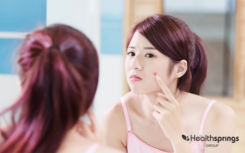 A Person with Acne Looking Into Mirror