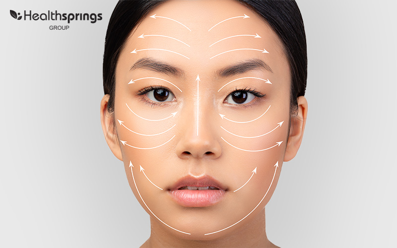 Womans Face With Arrows Pointing Upwards to Represent Facelift