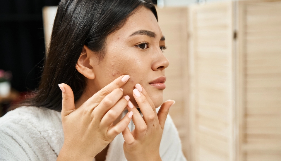 young asian woman with brunette hair examining her skin bathroom mirror skin condition