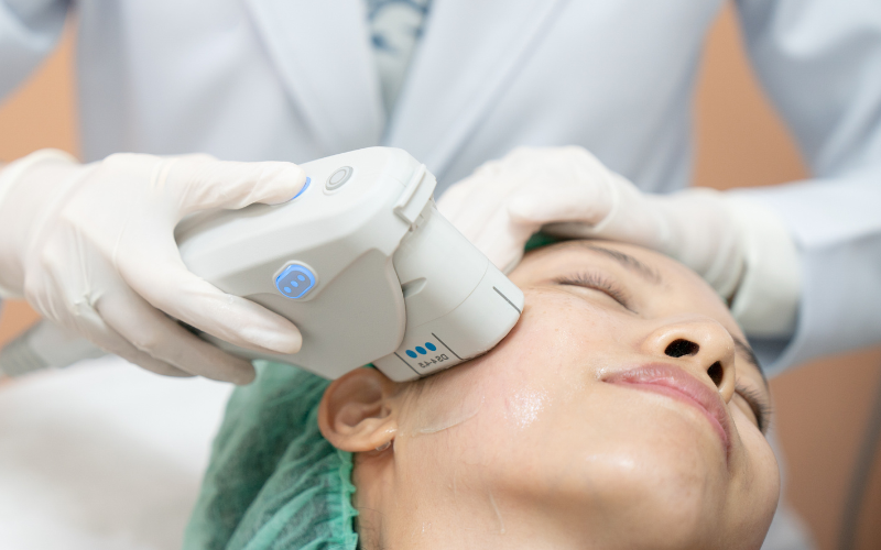 laser_treatment_singapore_healthsprings