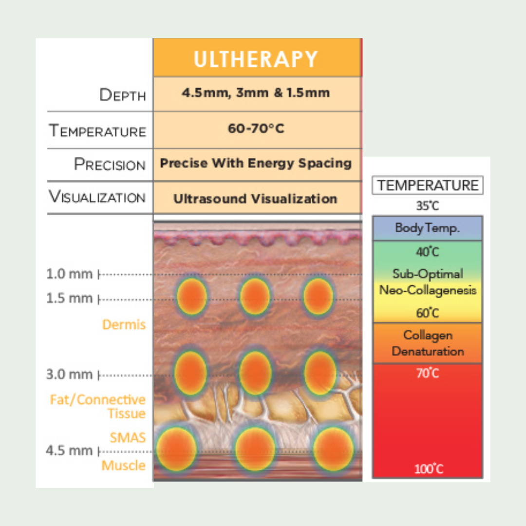 ultherapy_collagen_building