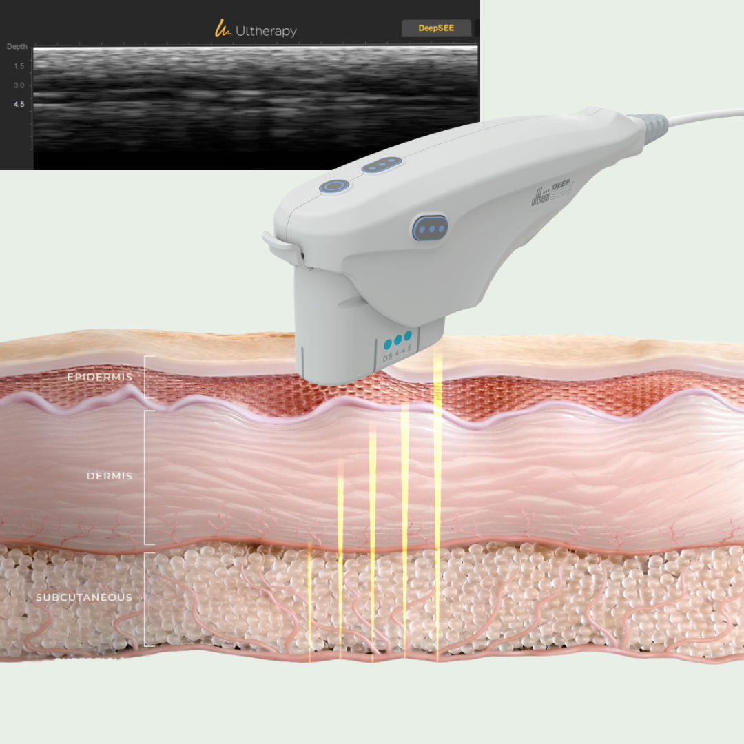 ultherapy_skin_layers_ultrasound