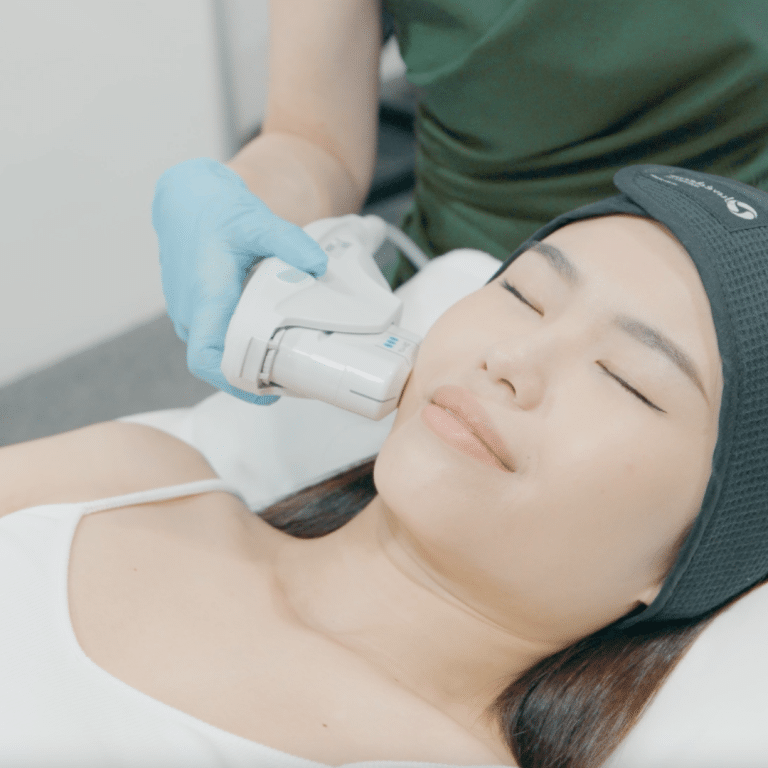 ultherapy_singapore_healthsprings