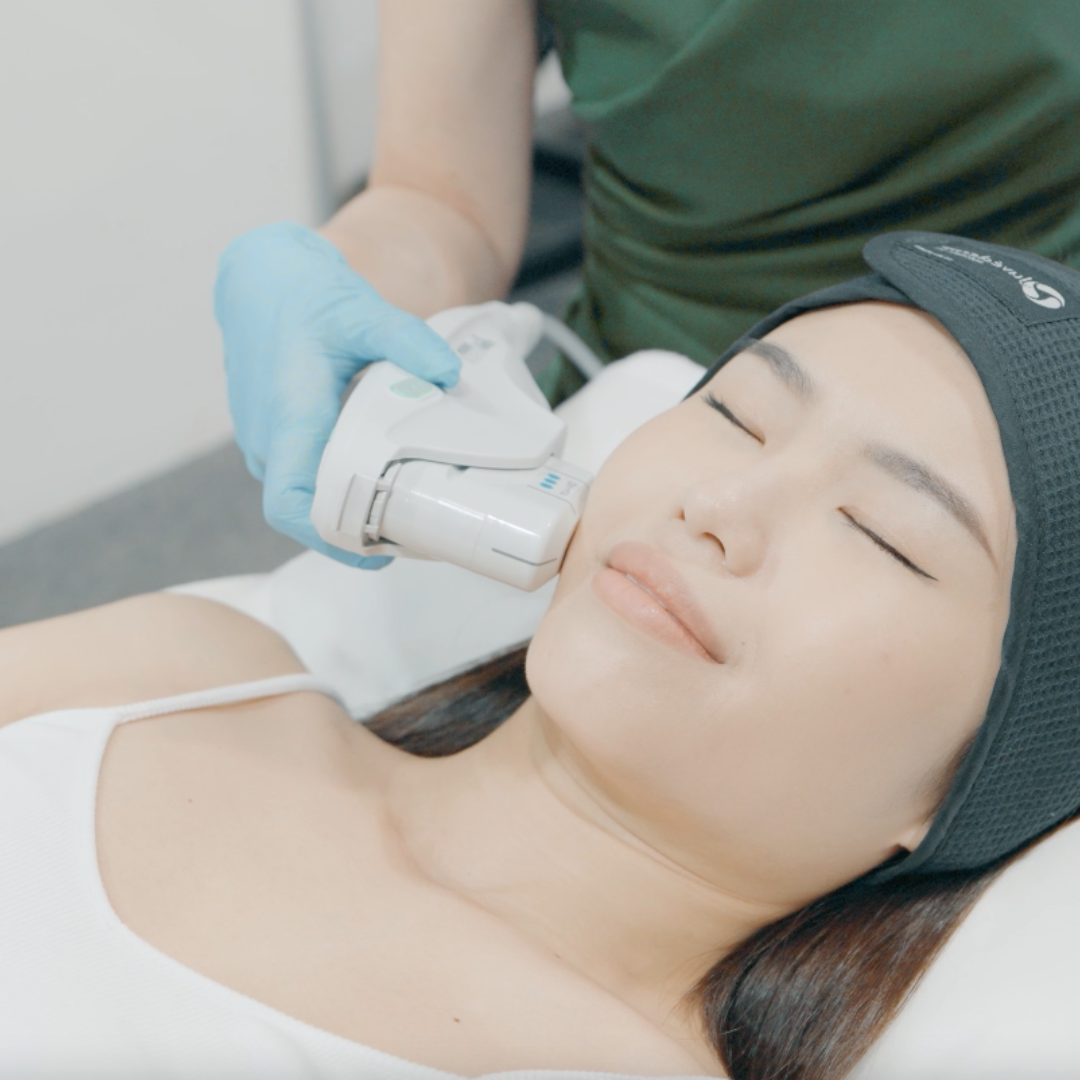 ultherapy_singapore_healthsprings