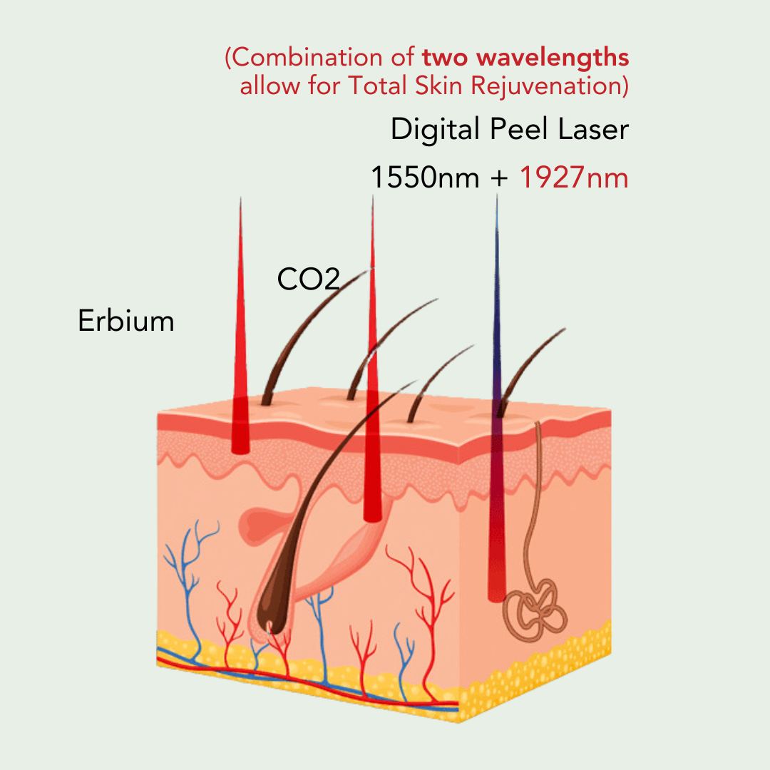 digital peel dual wavelength