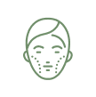 Frown Lines (Glabellar Lines)