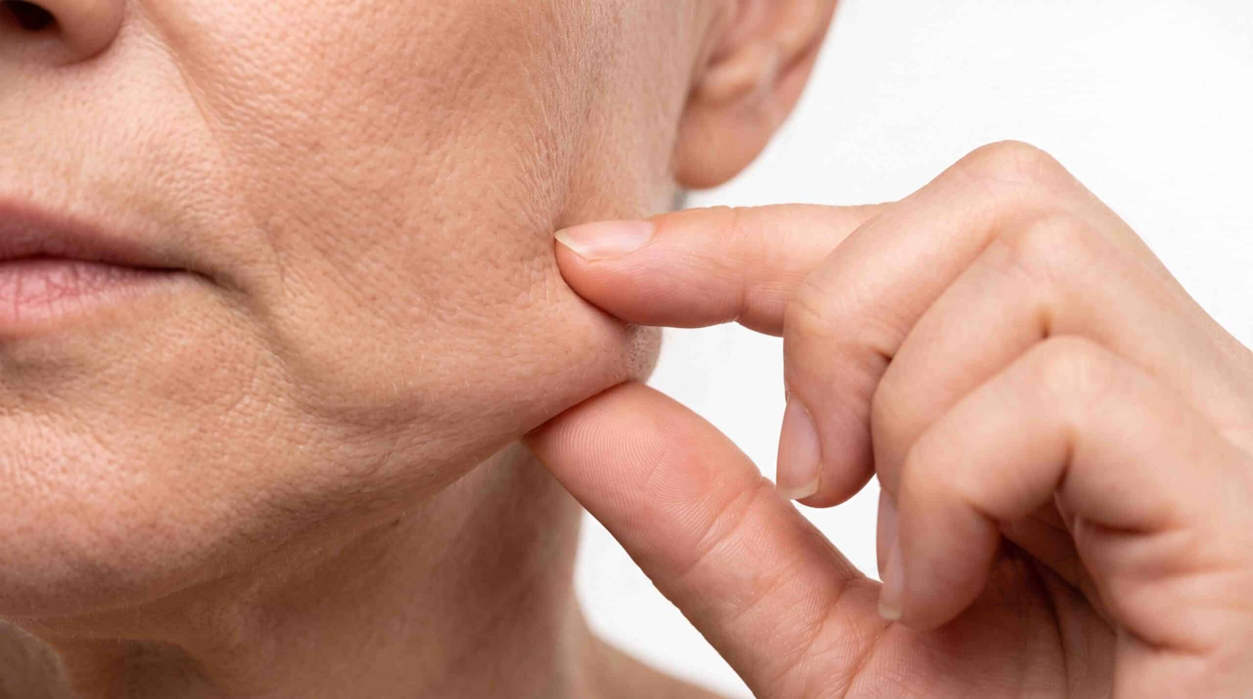 sagging face treatment