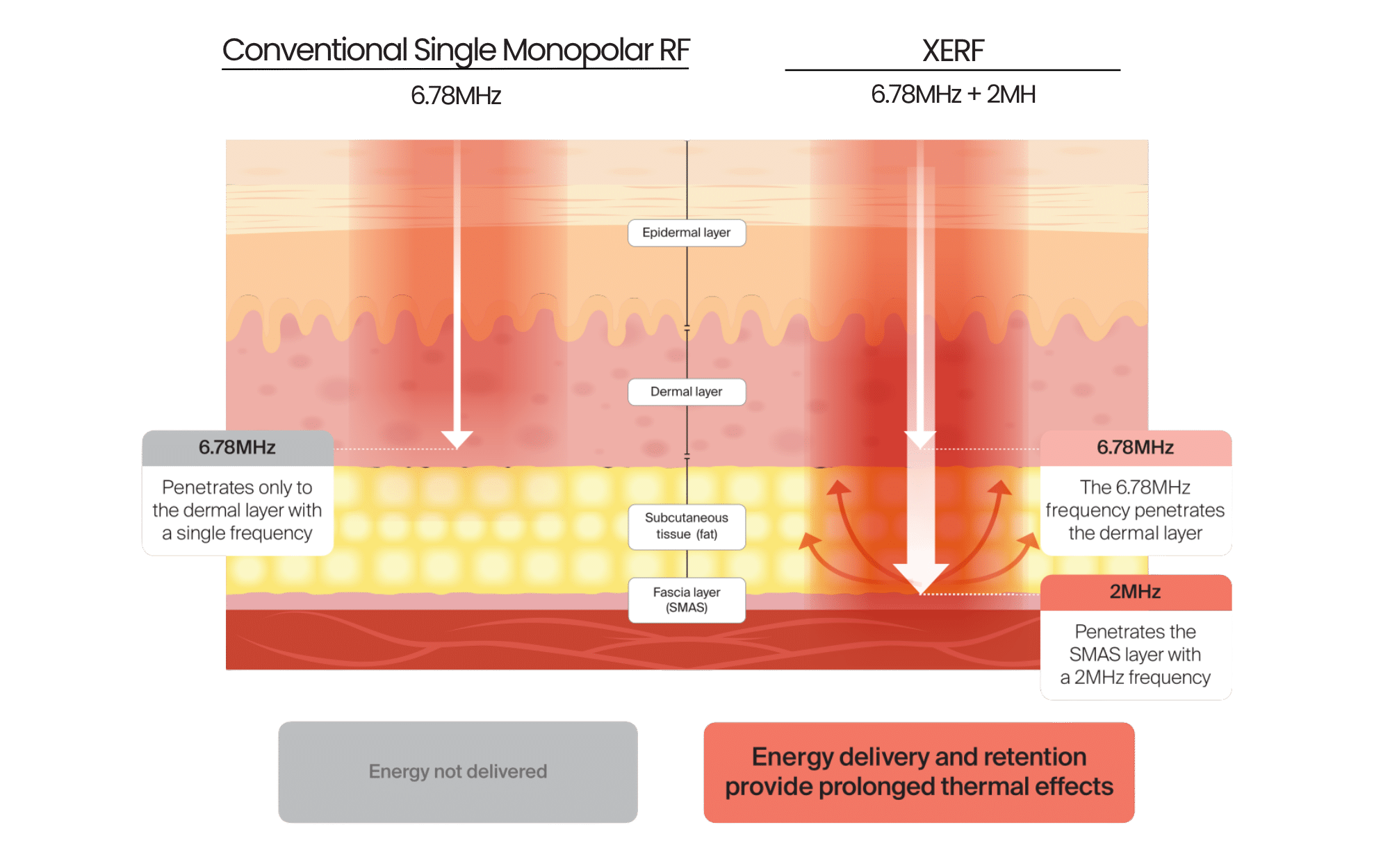 how xerf work