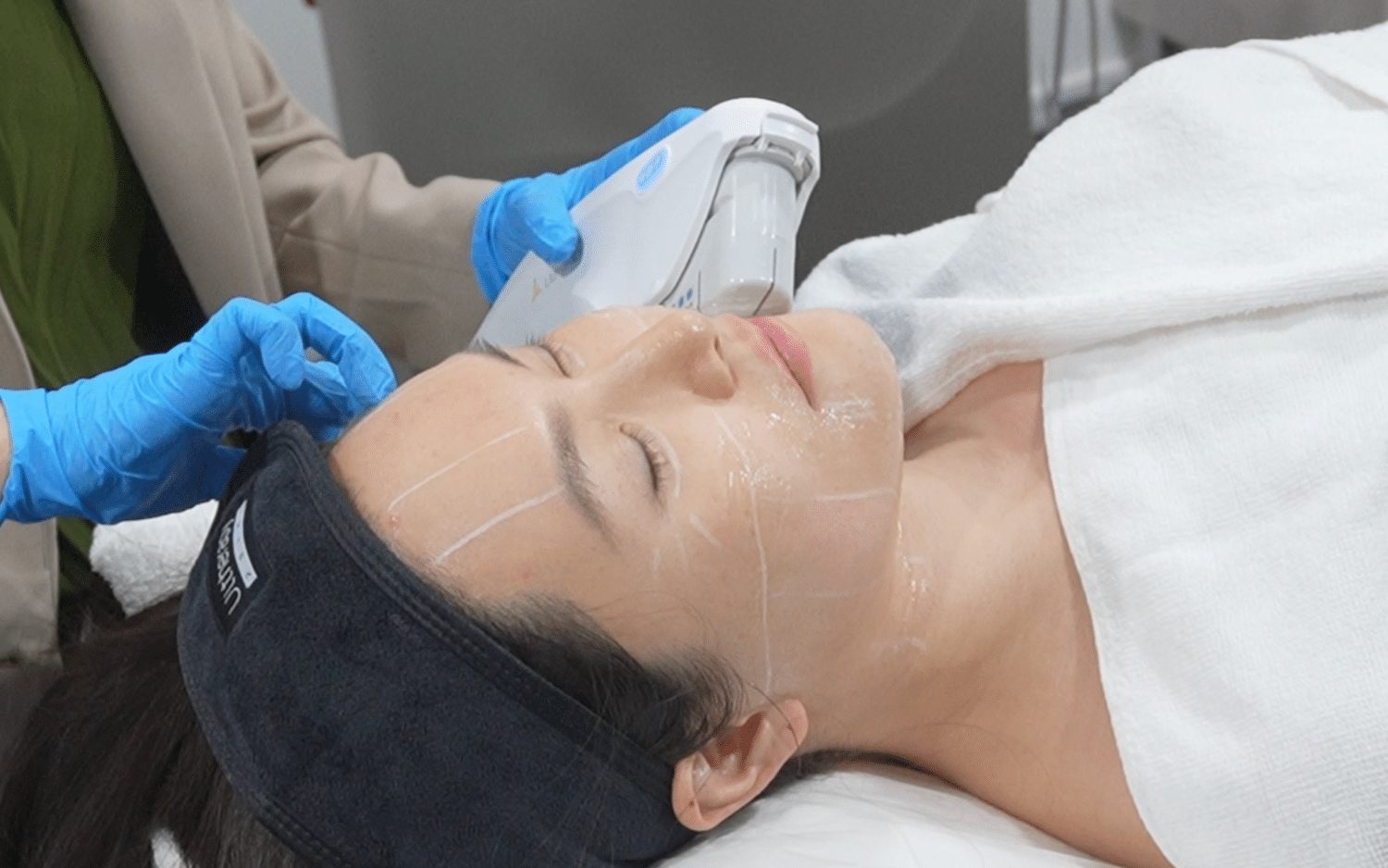 Ultherapy Aftercare Checklist Singapore Ultherapy Aftercare Checklist Singapore